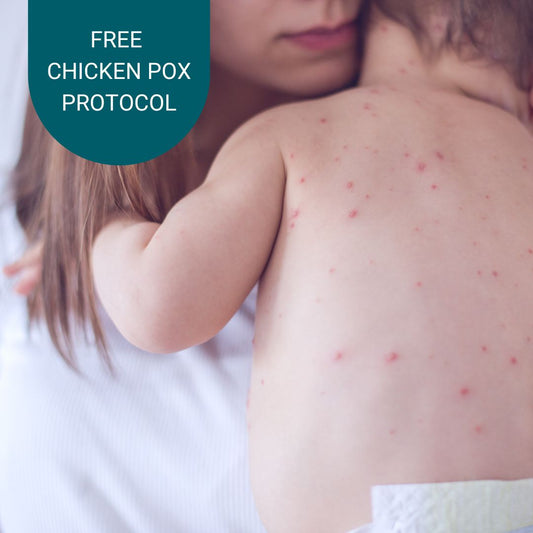 Natural Chicken Pox Protocol