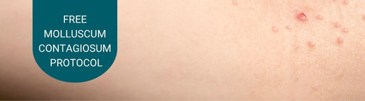 Natural Health Protocol for Molluscum: Support Your Child’s Immunity from the Inside Out